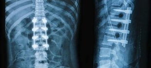 x-ray della schiena