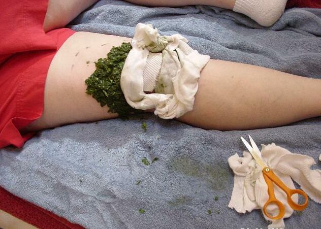 Un impacco caldo di purè di foglie di cavolo su un'articolazione del ginocchio dolorante con l'artrosi
